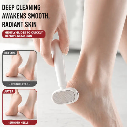 Dual-Sided Foot Callus Remover - White-Red - 4x Removers | Ultimate Home & Travel Pack (Save 71%) — $34.95 (Only $8.74/ea) 👑 [Best Value]