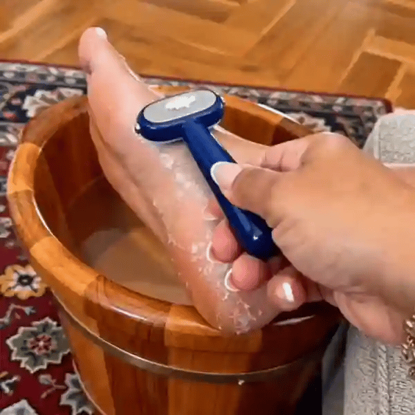 🦶 [50% OFF TODAY] Dual-Sided Foot Callus Remover & Scraper — Replaceable Stainless Steel Blades for Silky Smooth Heels ✨ (JG)