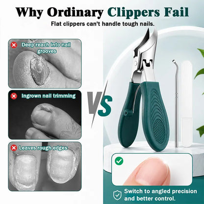 Buy 3 GET 2 FREE🎁Eagle Beak Angled Nail Clippers 3-Piece Set (With Nail Lifter & File) — Podiatrist-Grade Thick & Ingrown Toenail Trimmer 🦶✂️