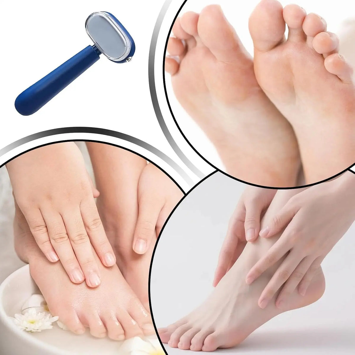 Dual-Sided Foot Callus Remover Detail